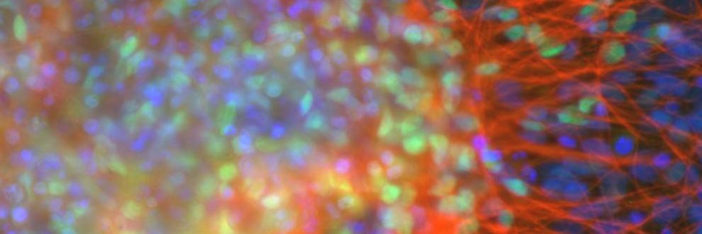 représentation de l'activité cérébrale sous hypnose